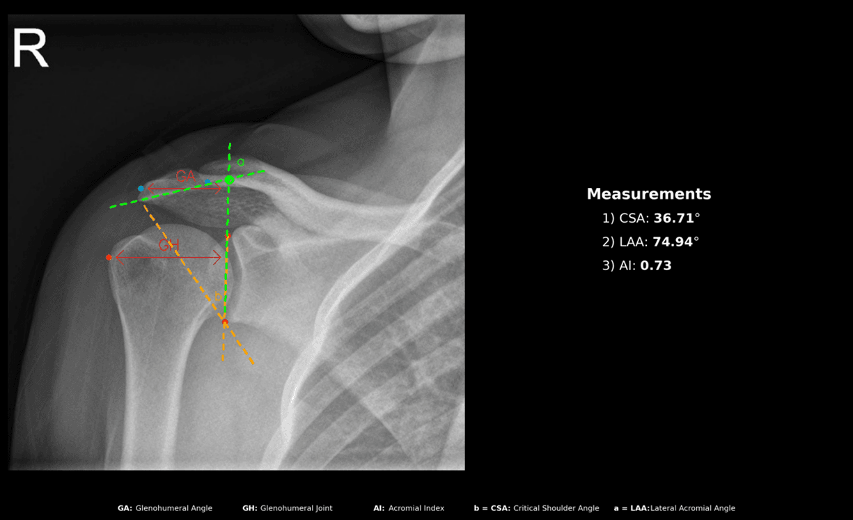 CalculOrther shoulder module output