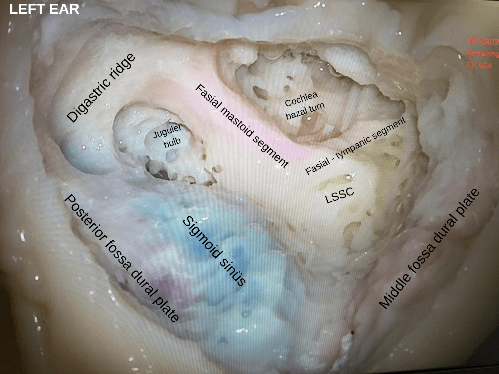 Labeled left ear anatomy plate