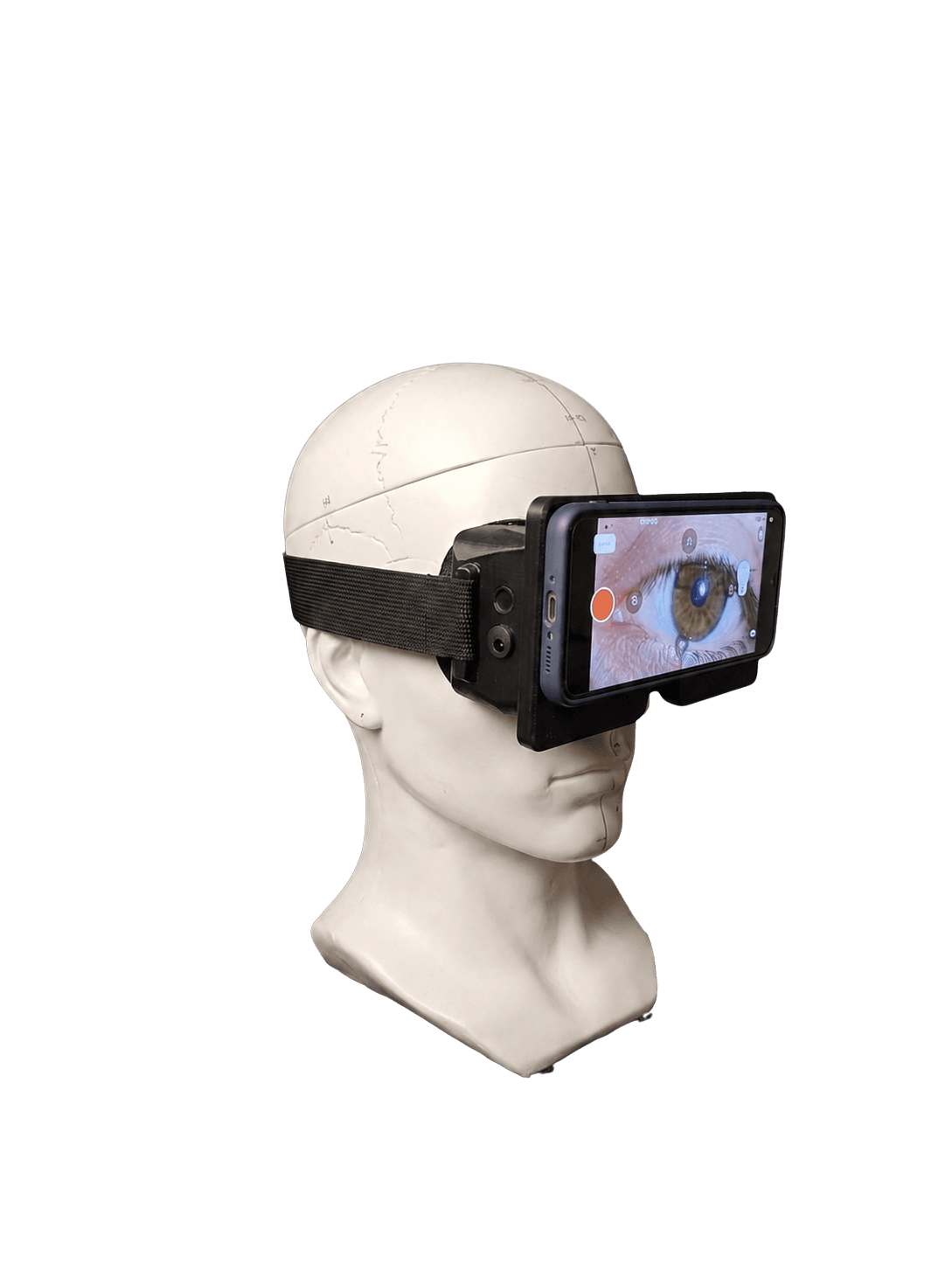 vNistagmus device worn on a mannequin with the app interface visible